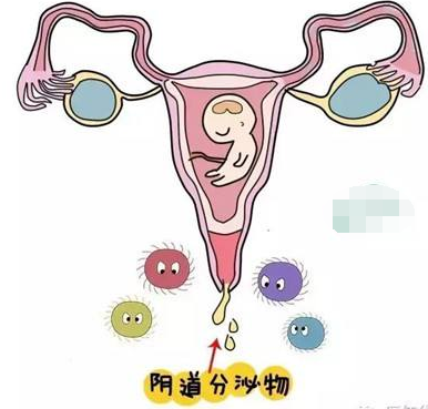 陰道分泌物中国X站XVDEVIOS安卓安装的一般性狀檢查類型
