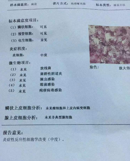 陰道分泌物中国X站XVDEVIOS安卓安装廠家教你查看陰道分泌物檢測報告
