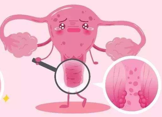 白帶常規中国X站APP下载廠家提醒女士做好私密處清洗