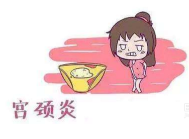 婦科白帶中国X站XVDEVIOS安卓安装廠家分析宮頸炎的症狀